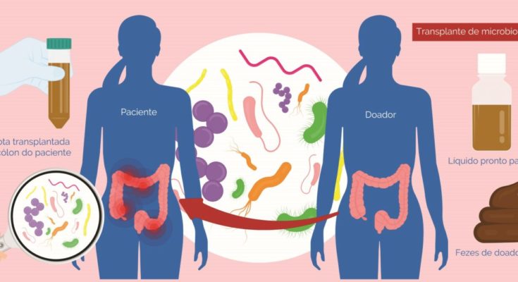 Transplante de microbiota fecal